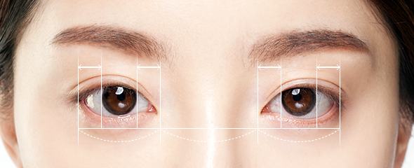 canthoplasty korea - Epicanthoplasty in Korea