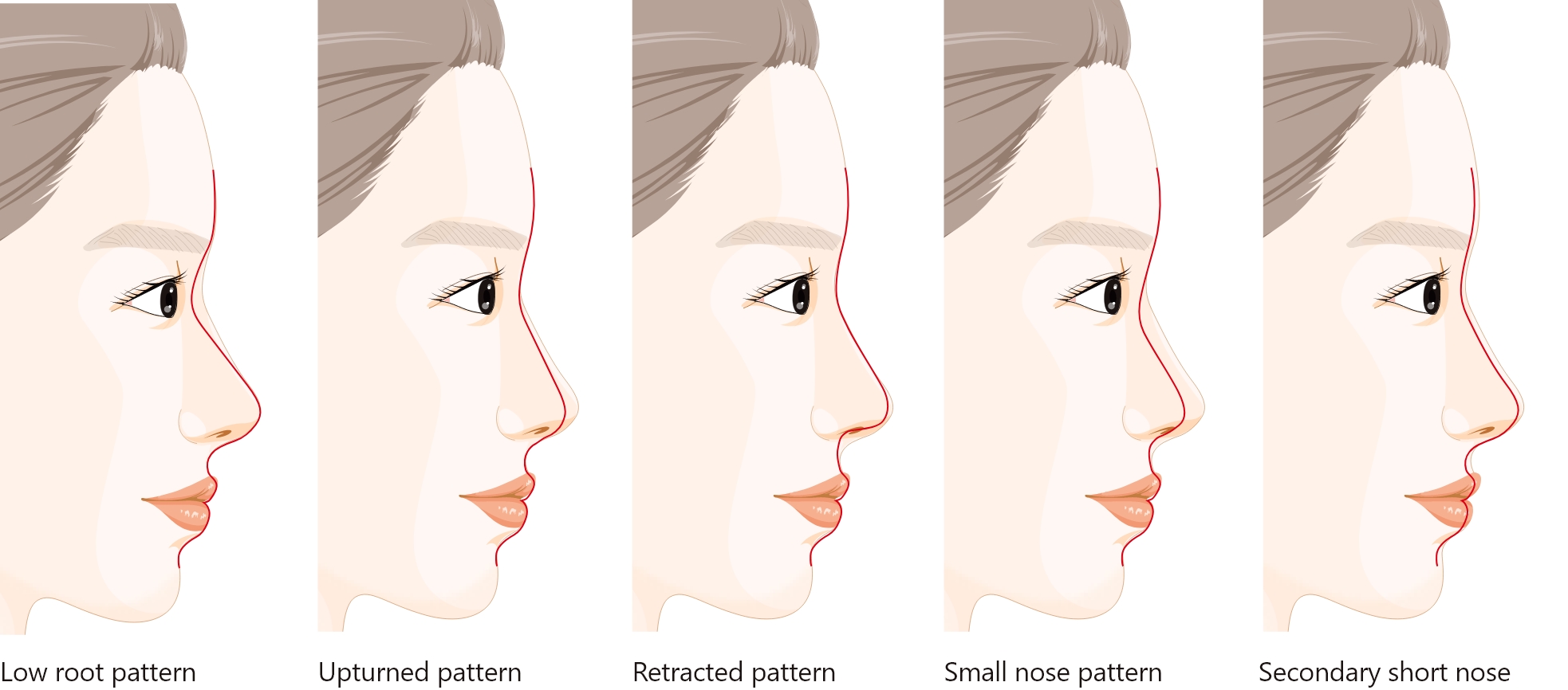 Short nose classification