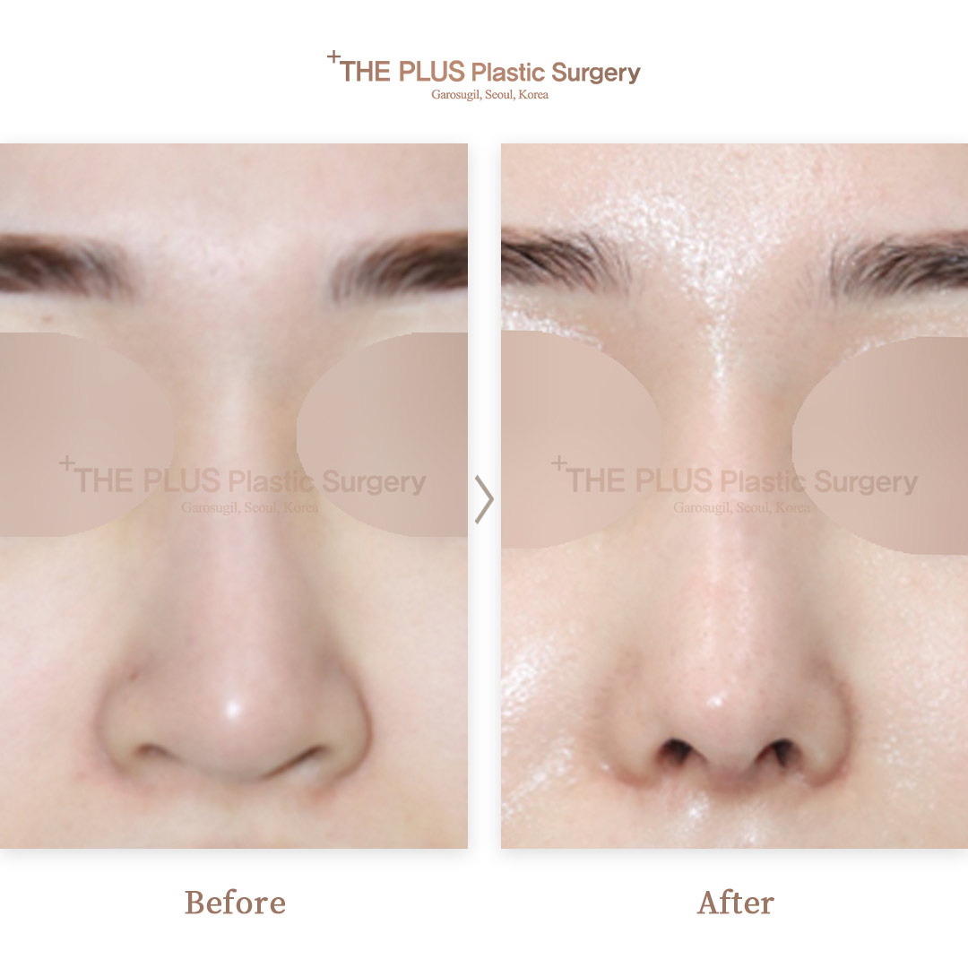 THE PLUS CLINIC KOREA -