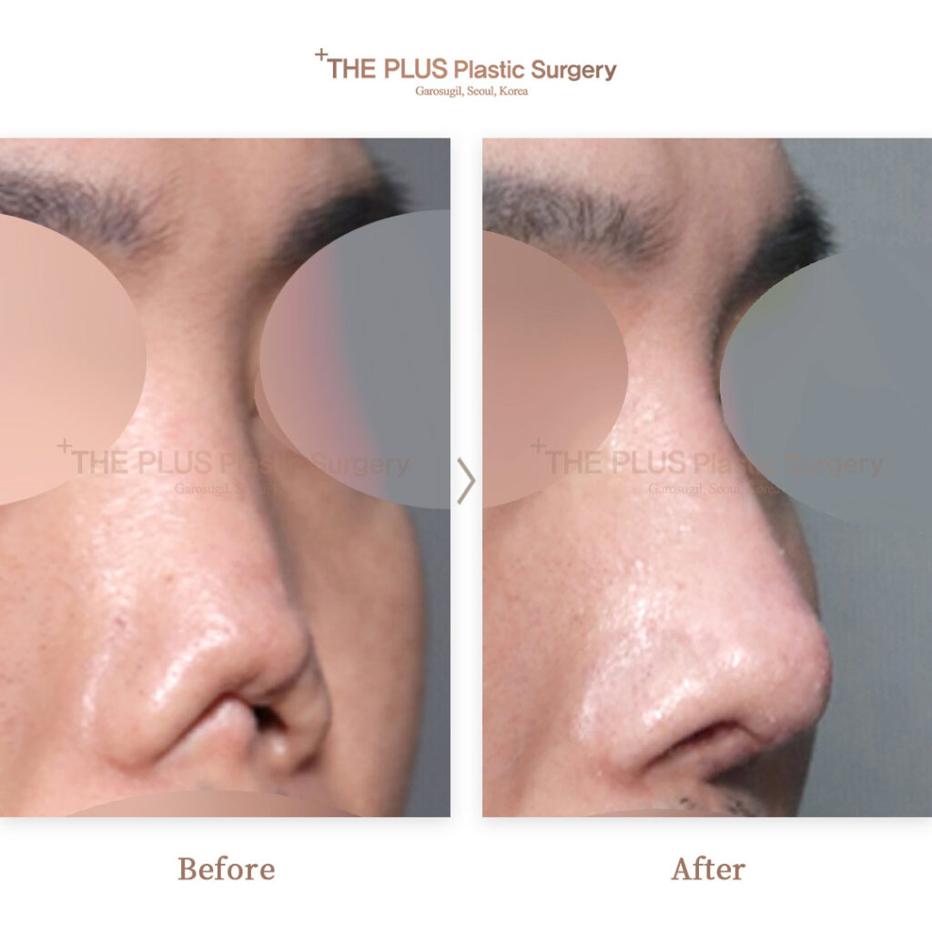 THE PLUS CLINIC KOREA -