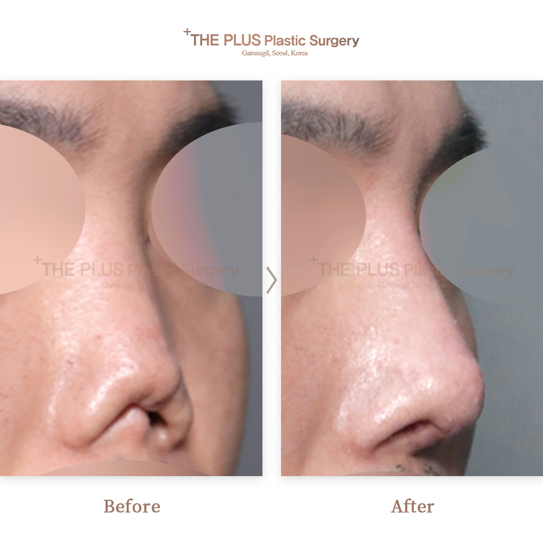 THE PLUS CLINIC KOREA -