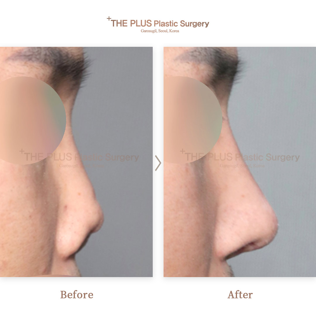 THE PLUS CLINIC KOREA -