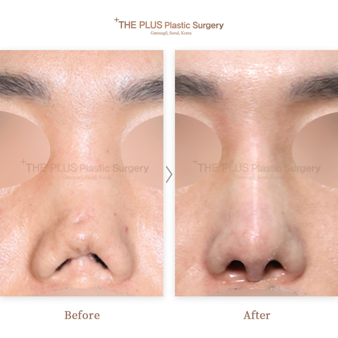 THE PLUS CLINIC KOREA -