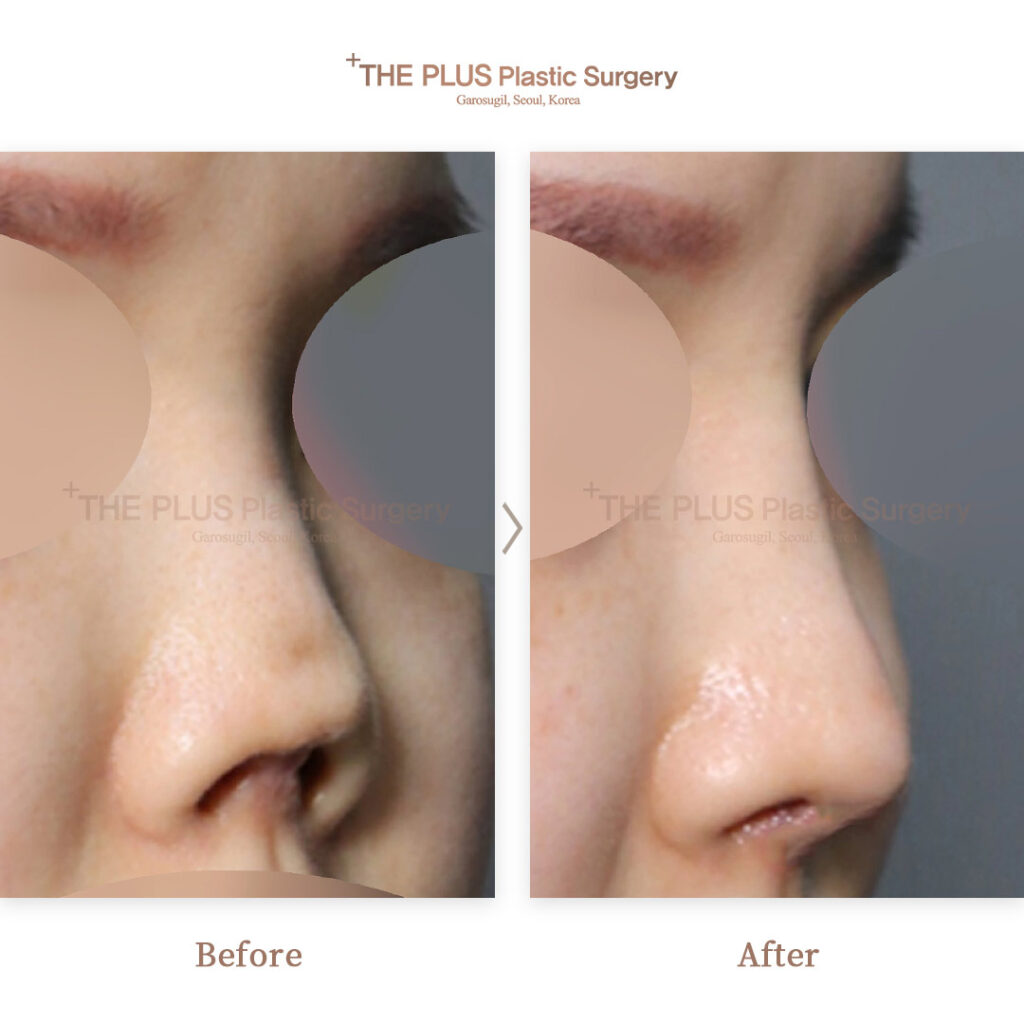 THE PLUS CLINIC KOREA -