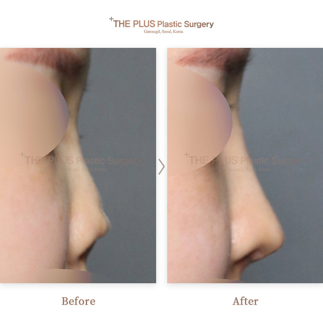 THE PLUS CLINIC KOREA -