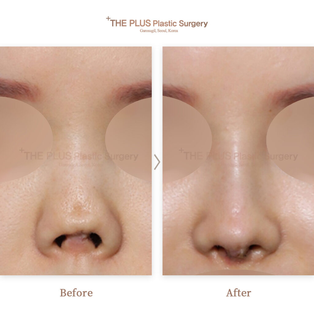 THE PLUS CLINIC KOREA -