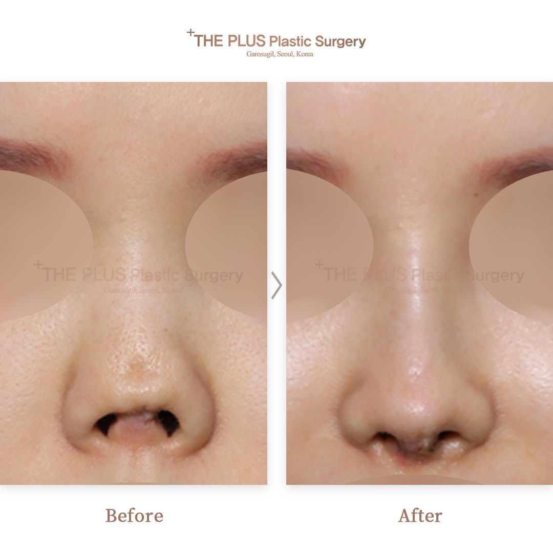 THE PLUS CLINIC KOREA -
