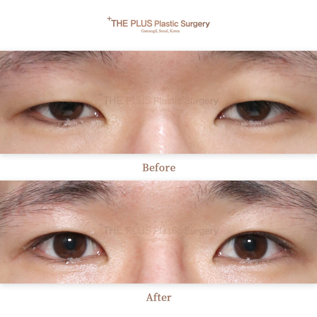 THE PLUS CLINIC KOREA -