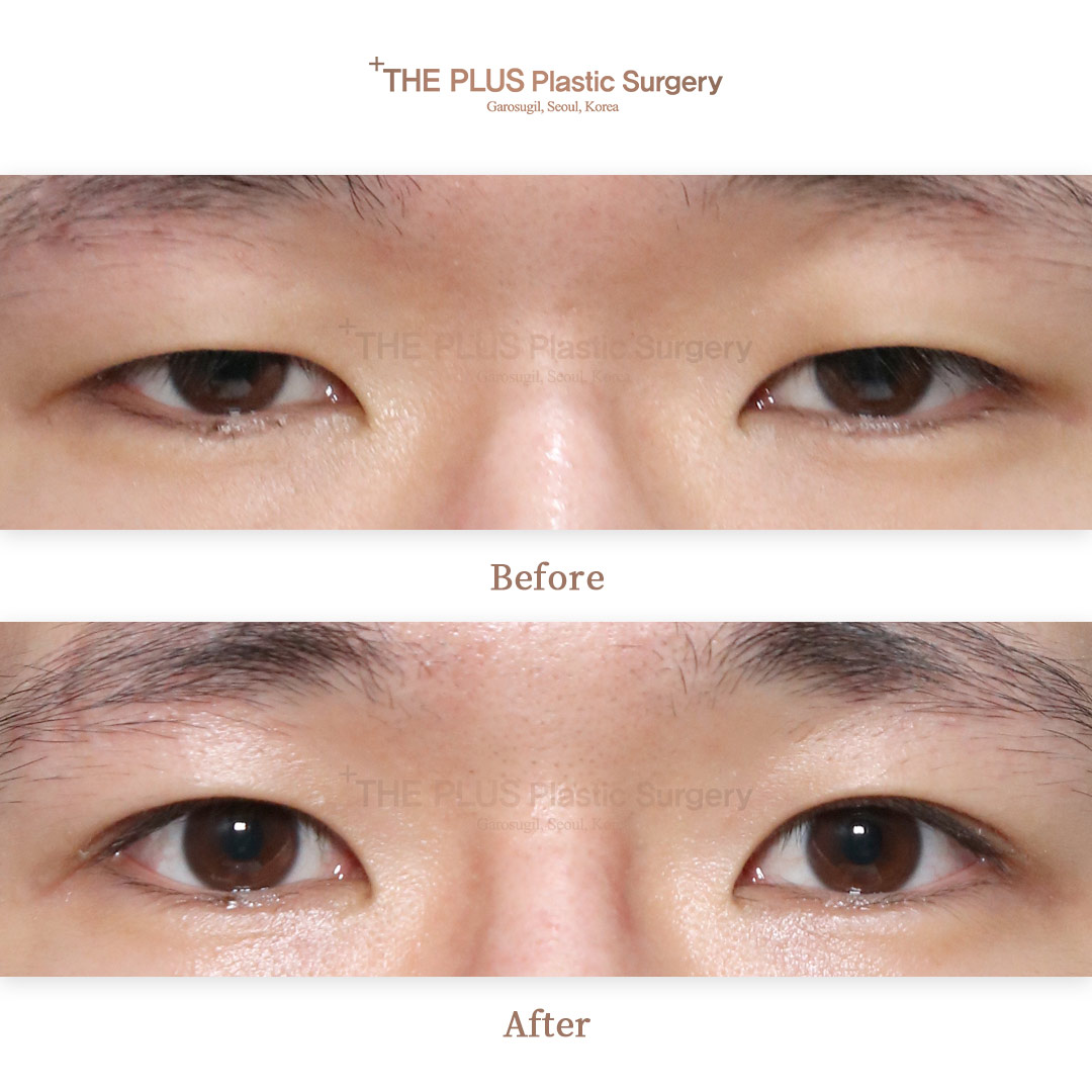 THE PLUS CLINIC KOREA -