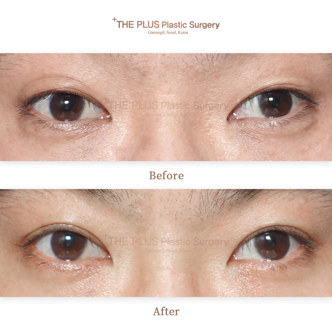 THE PLUS CLINIC KOREA -