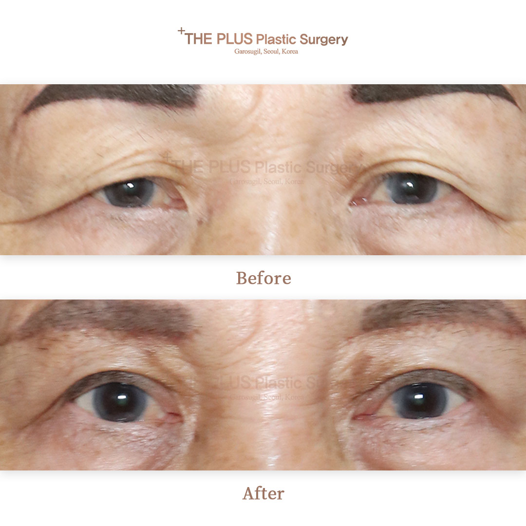 THE PLUS CLINIC KOREA -