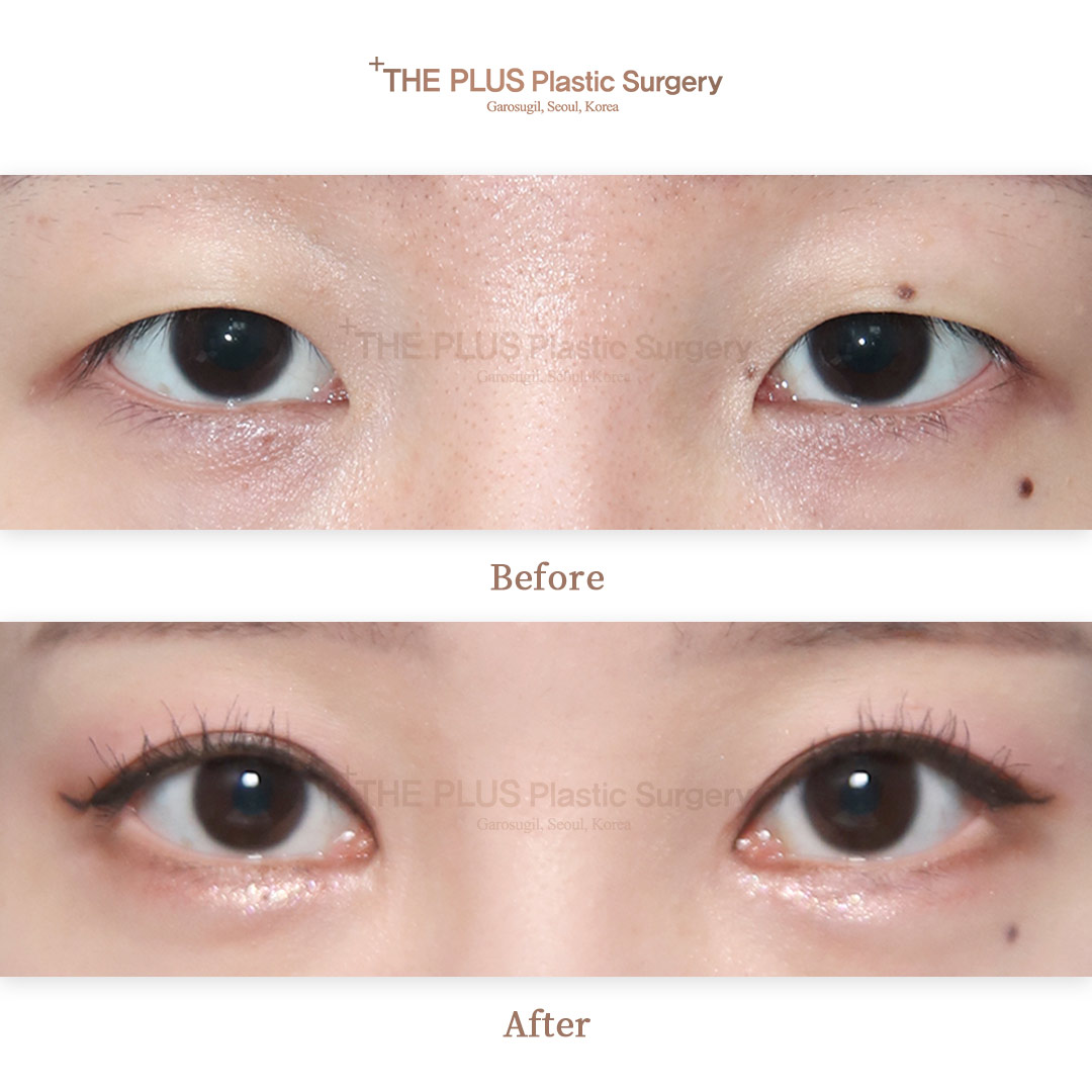 THE PLUS CLINIC KOREA -