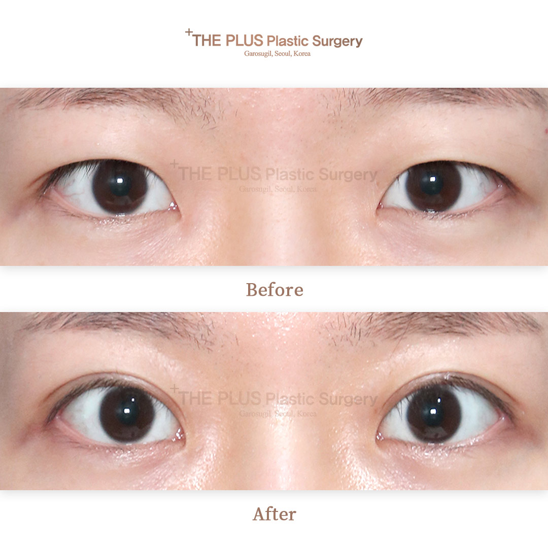 THE PLUS CLINIC KOREA -
