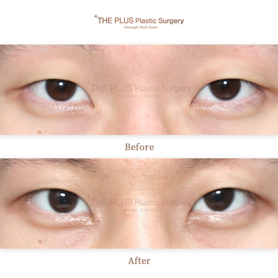 THE PLUS CLINIC KOREA -