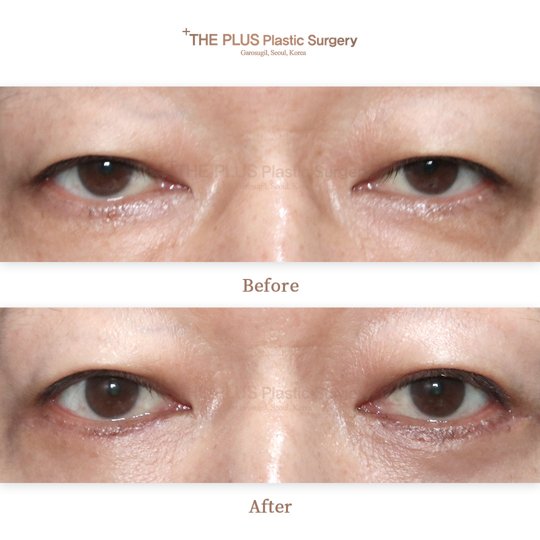 THE PLUS CLINIC KOREA -
