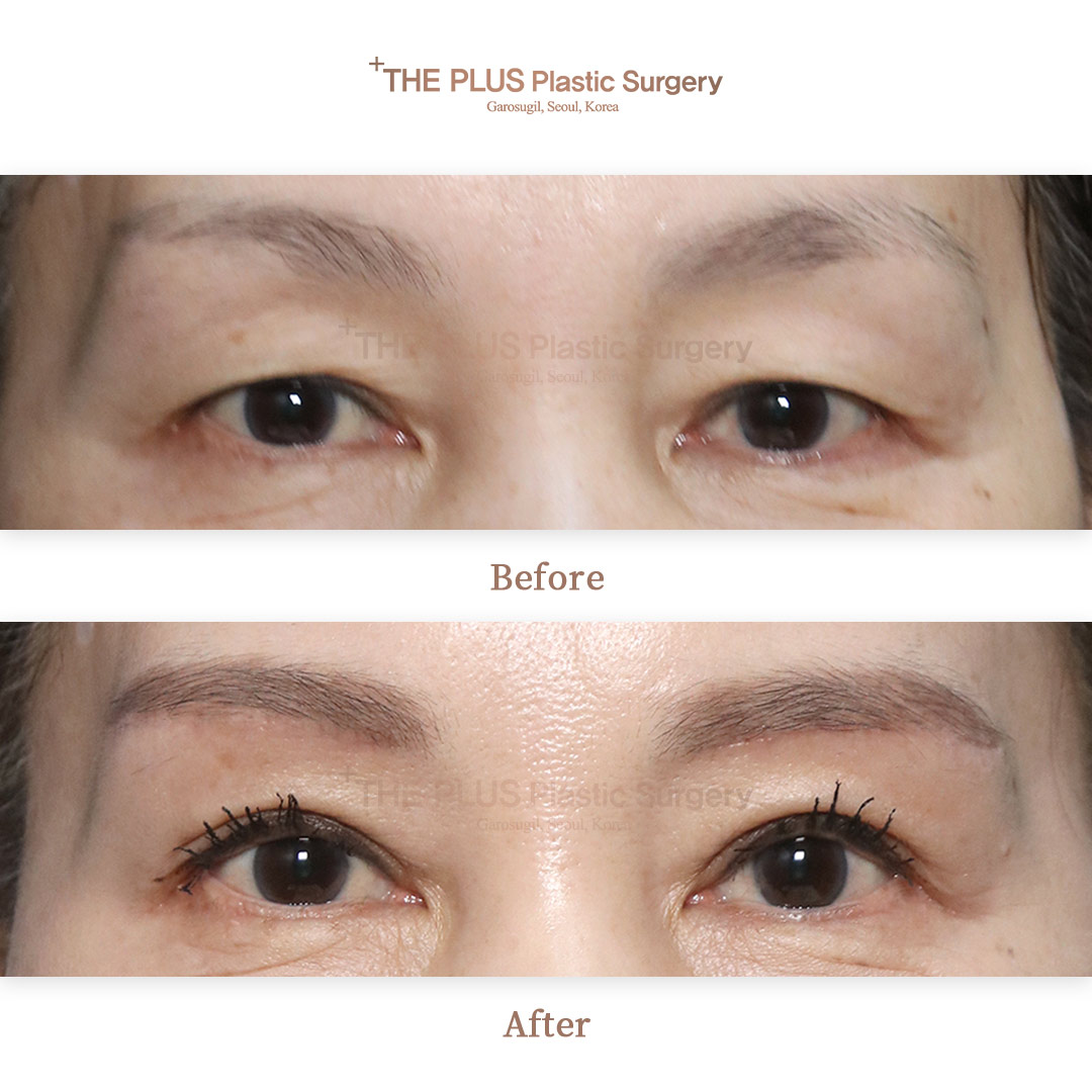 THE PLUS CLINIC KOREA -