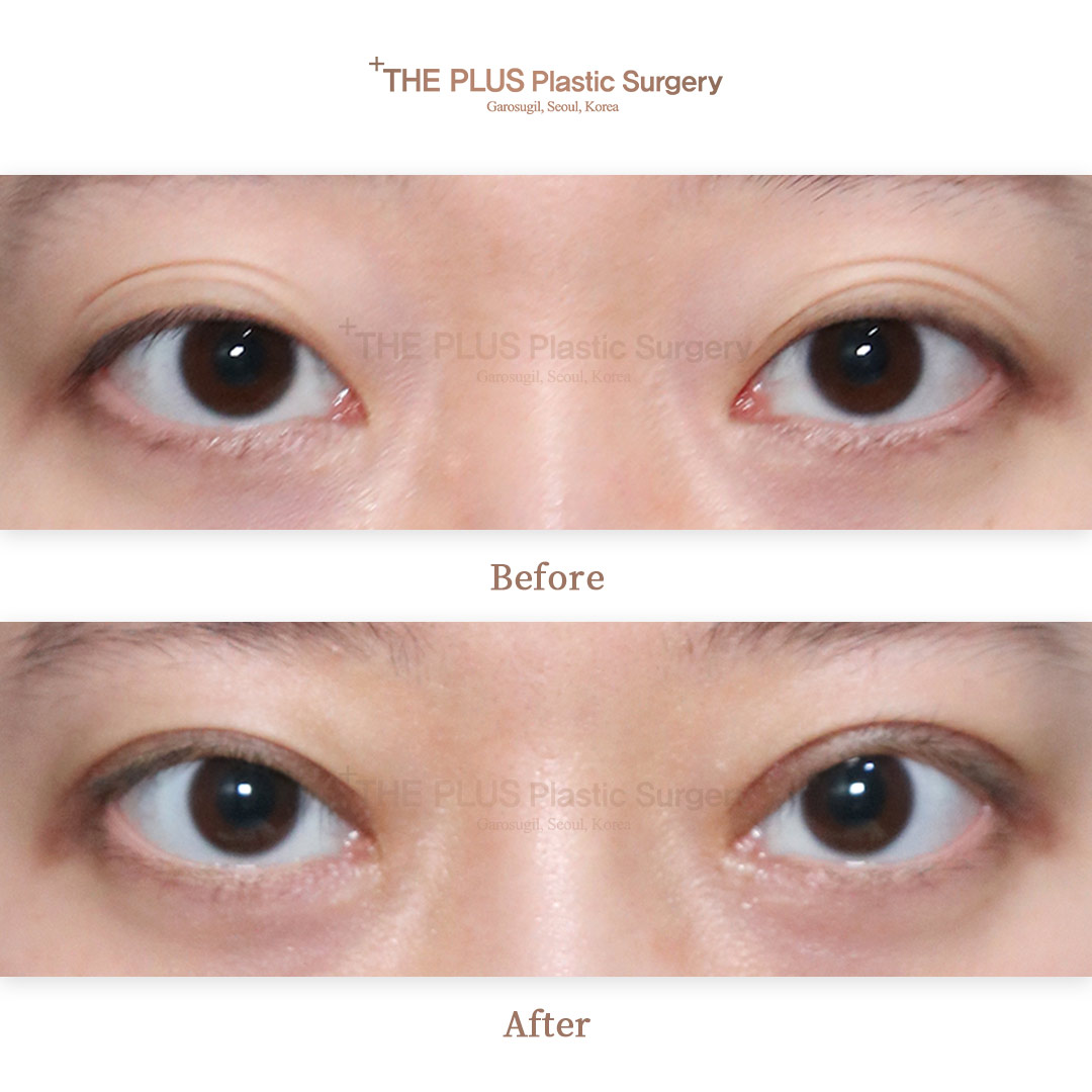 THE PLUS CLINIC KOREA -