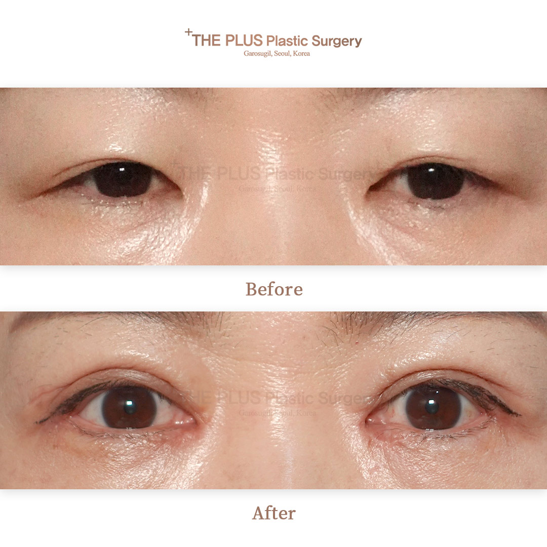 THE PLUS CLINIC KOREA -