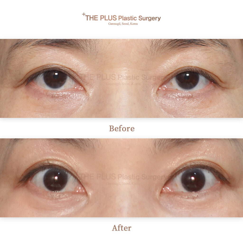 THE PLUS CLINIC KOREA -