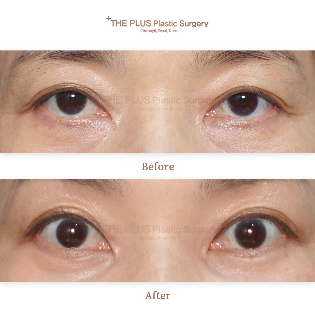 THE PLUS CLINIC KOREA -