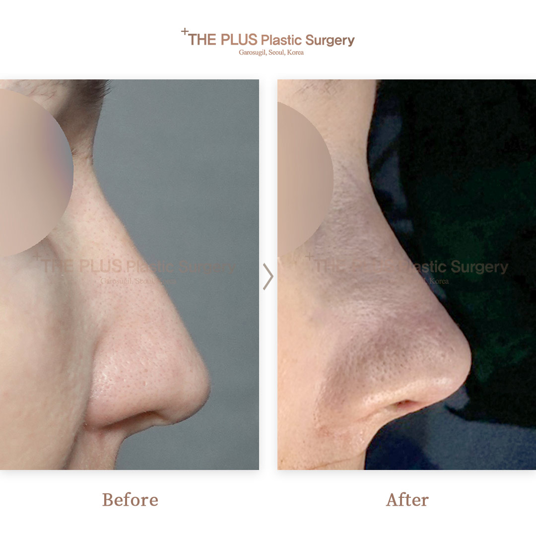 THE PLUS CLINIC KOREA -