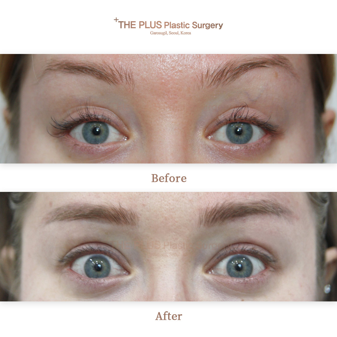 THE PLUS CLINIC KOREA -