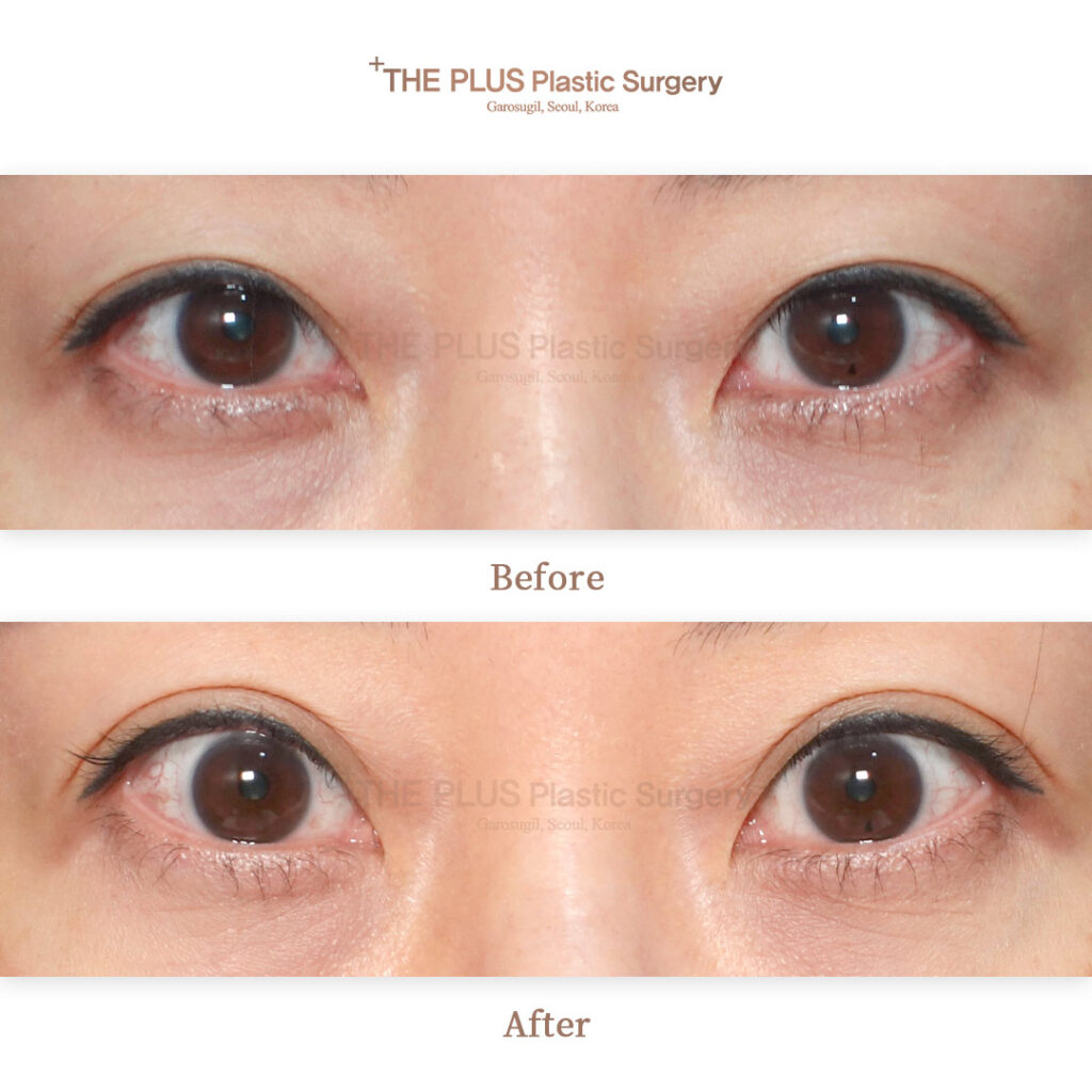 THE PLUS CLINIC KOREA -