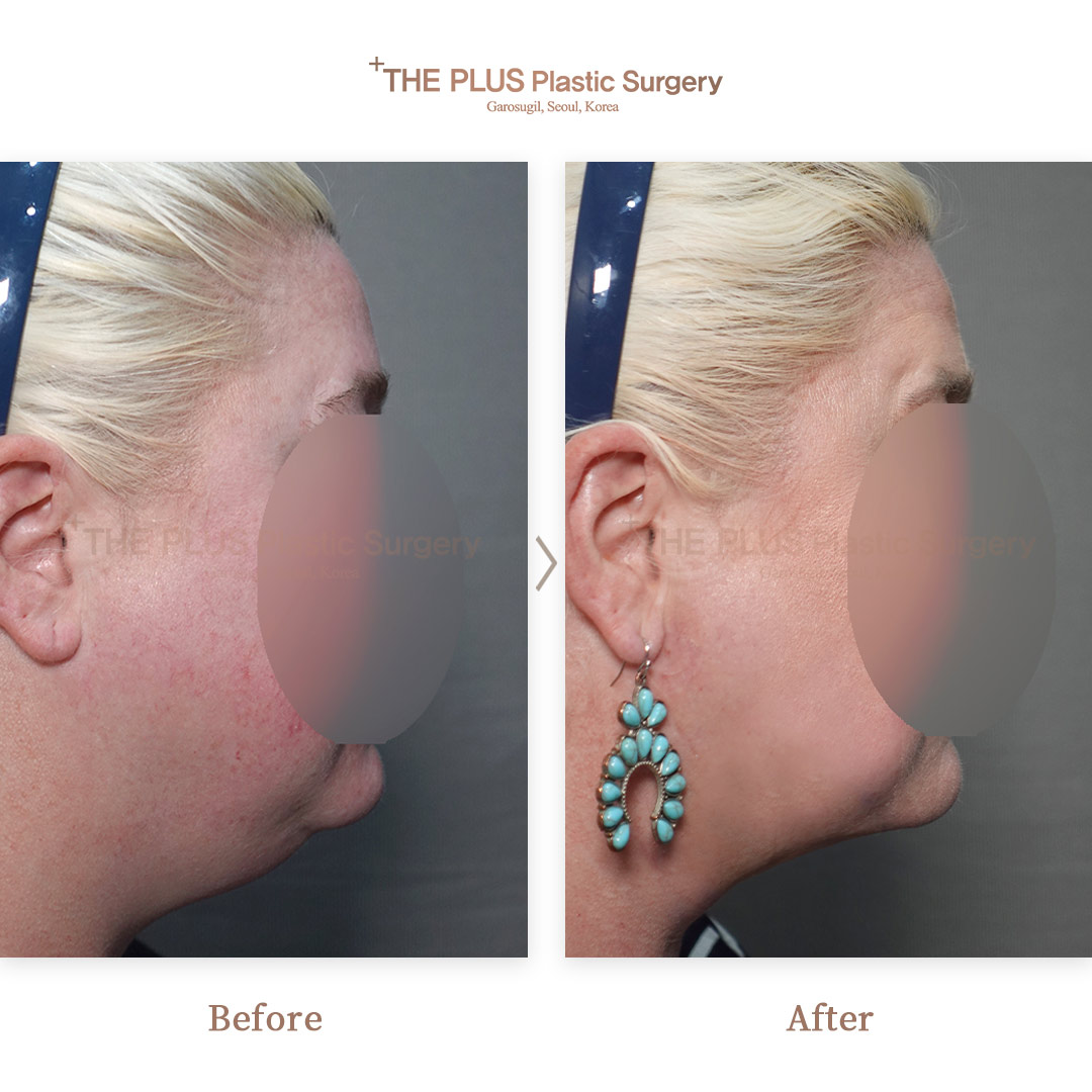 THE PLUS CLINIC KOREA -
