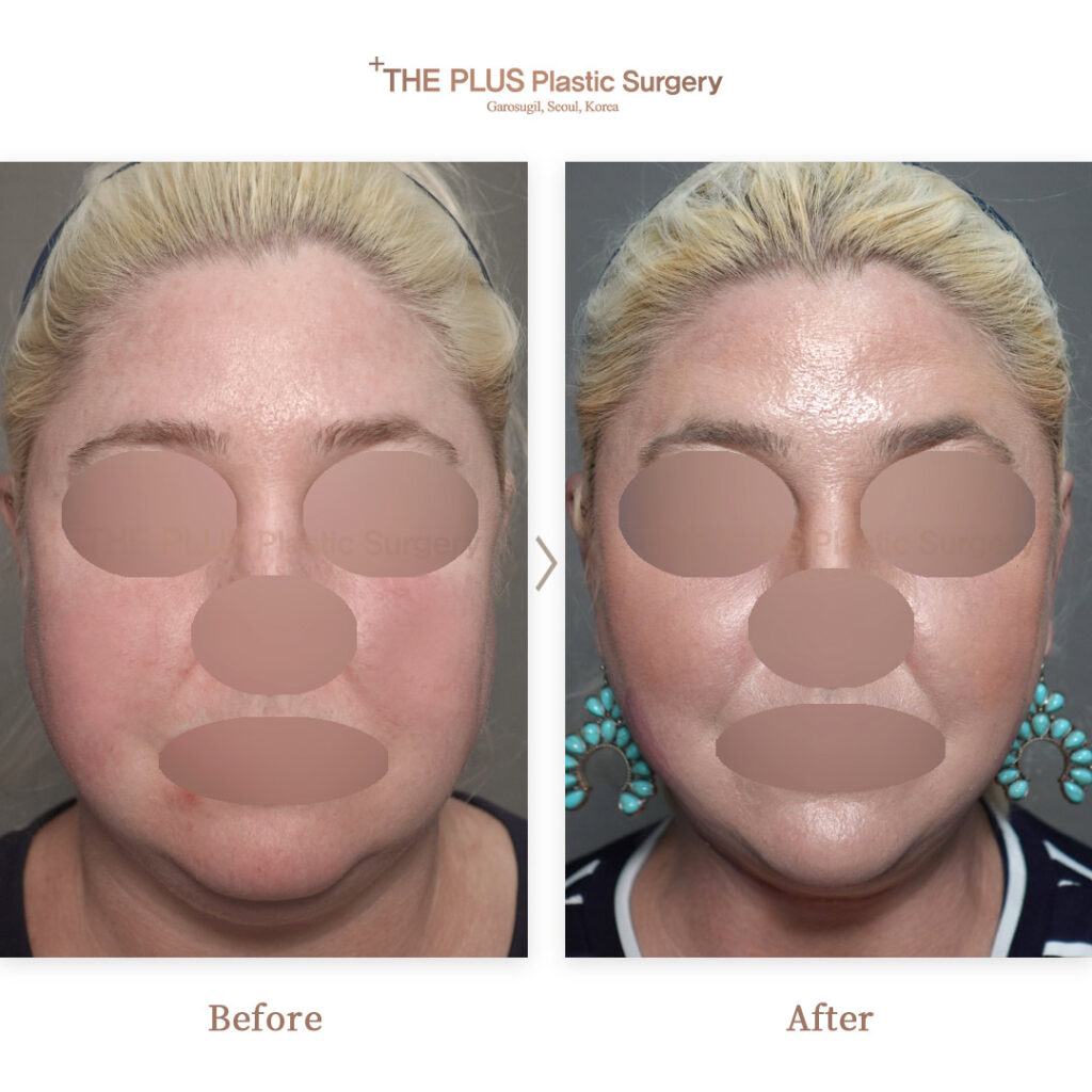 THE PLUS CLINIC KOREA -