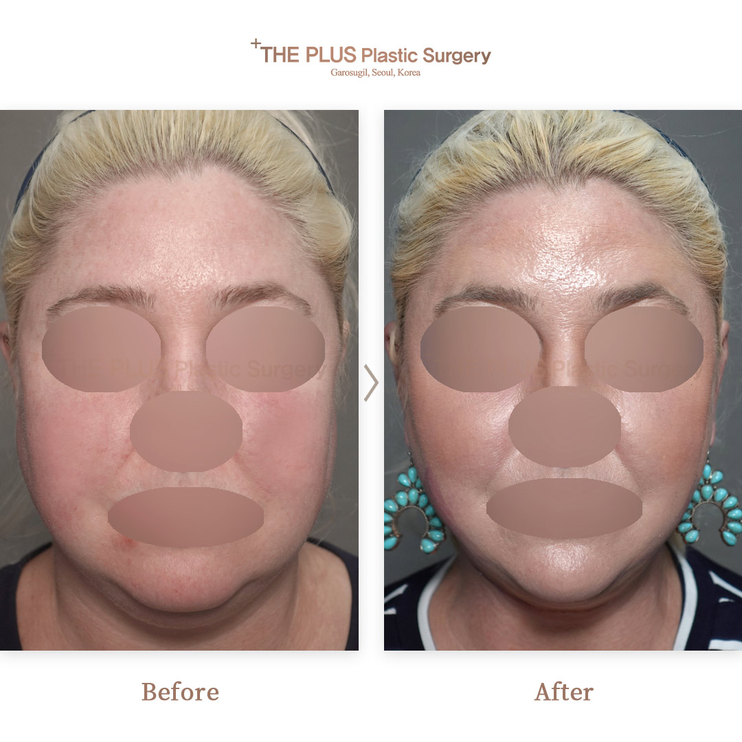THE PLUS CLINIC KOREA -