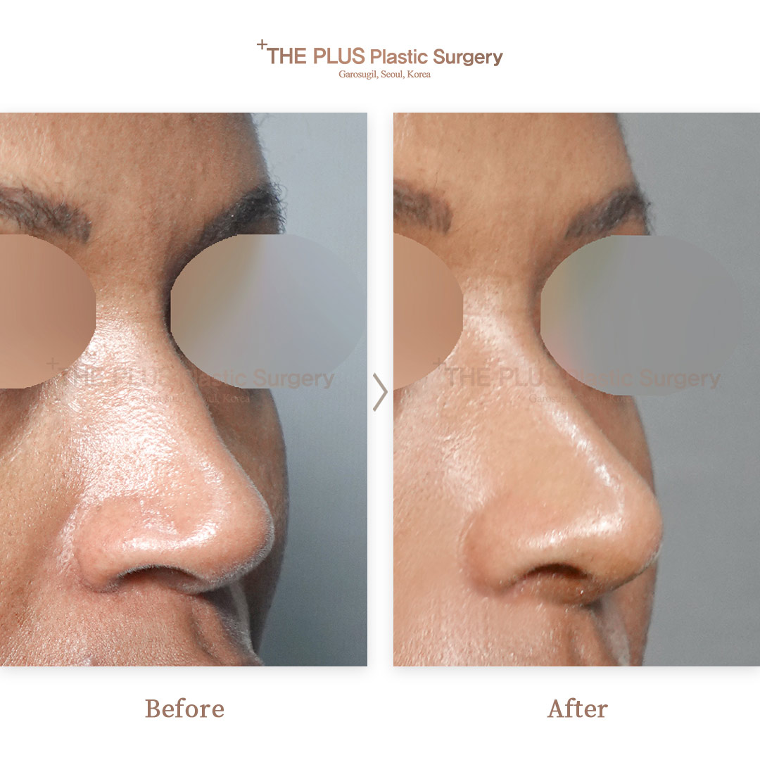 THE PLUS CLINIC KOREA -