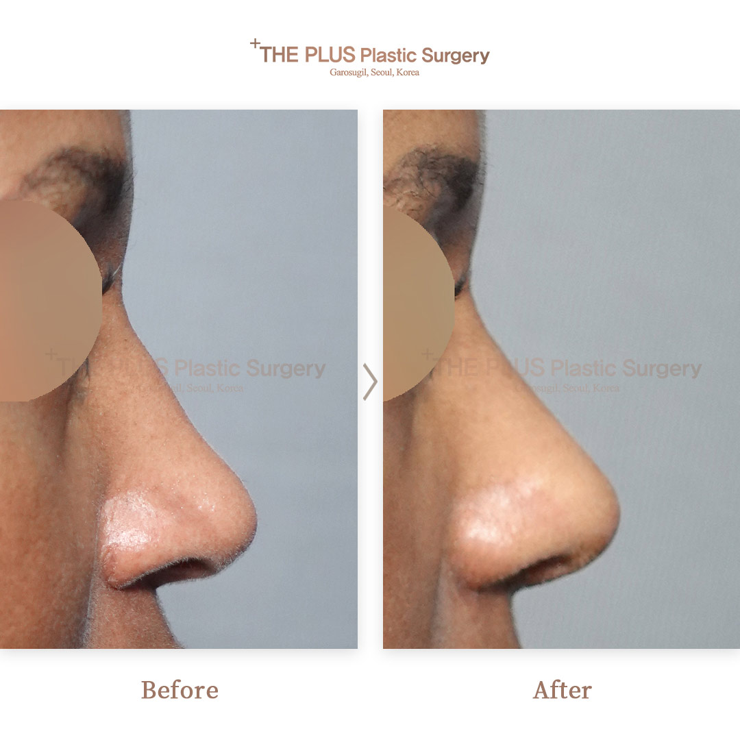 THE PLUS CLINIC KOREA -