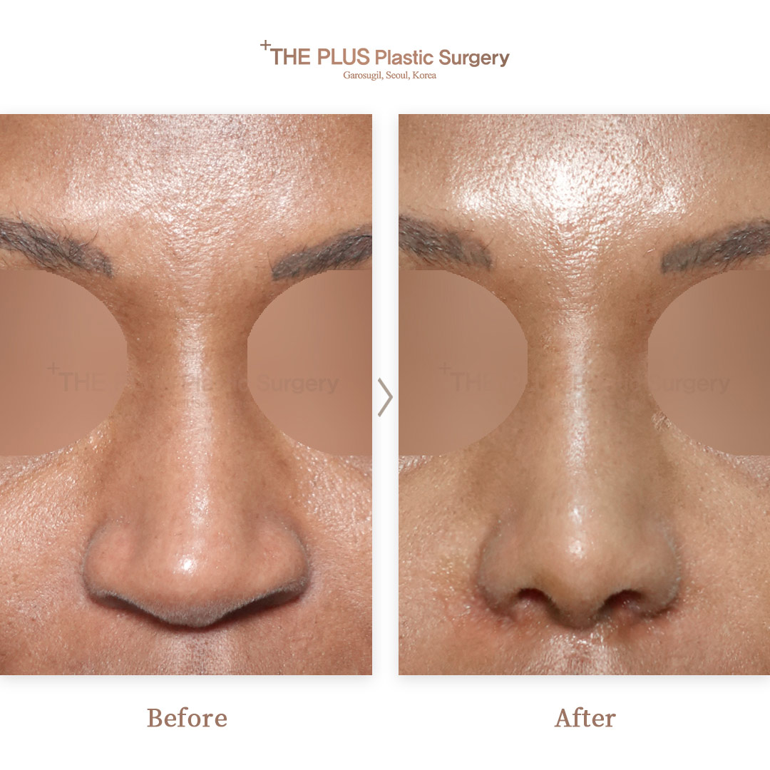 THE PLUS CLINIC KOREA -