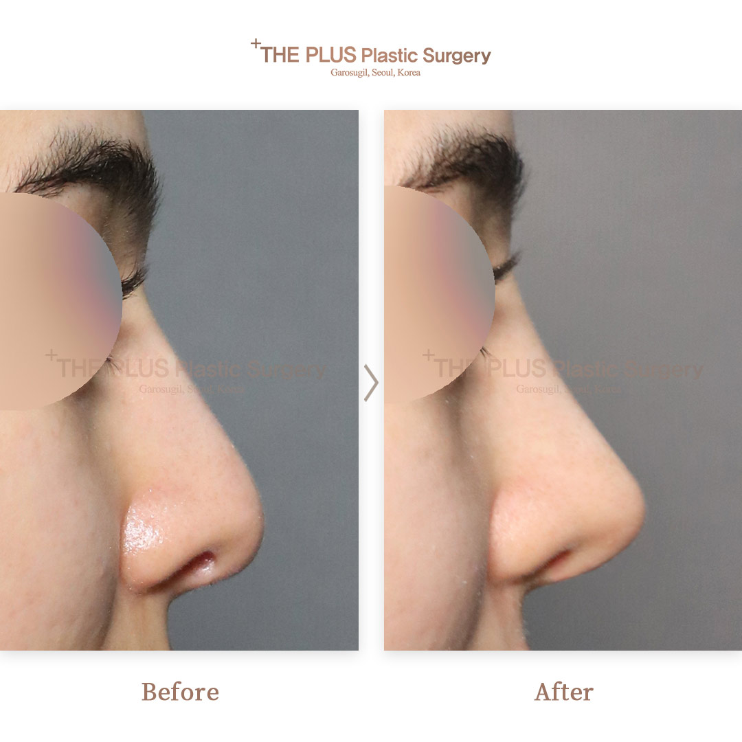 THE PLUS CLINIC KOREA -