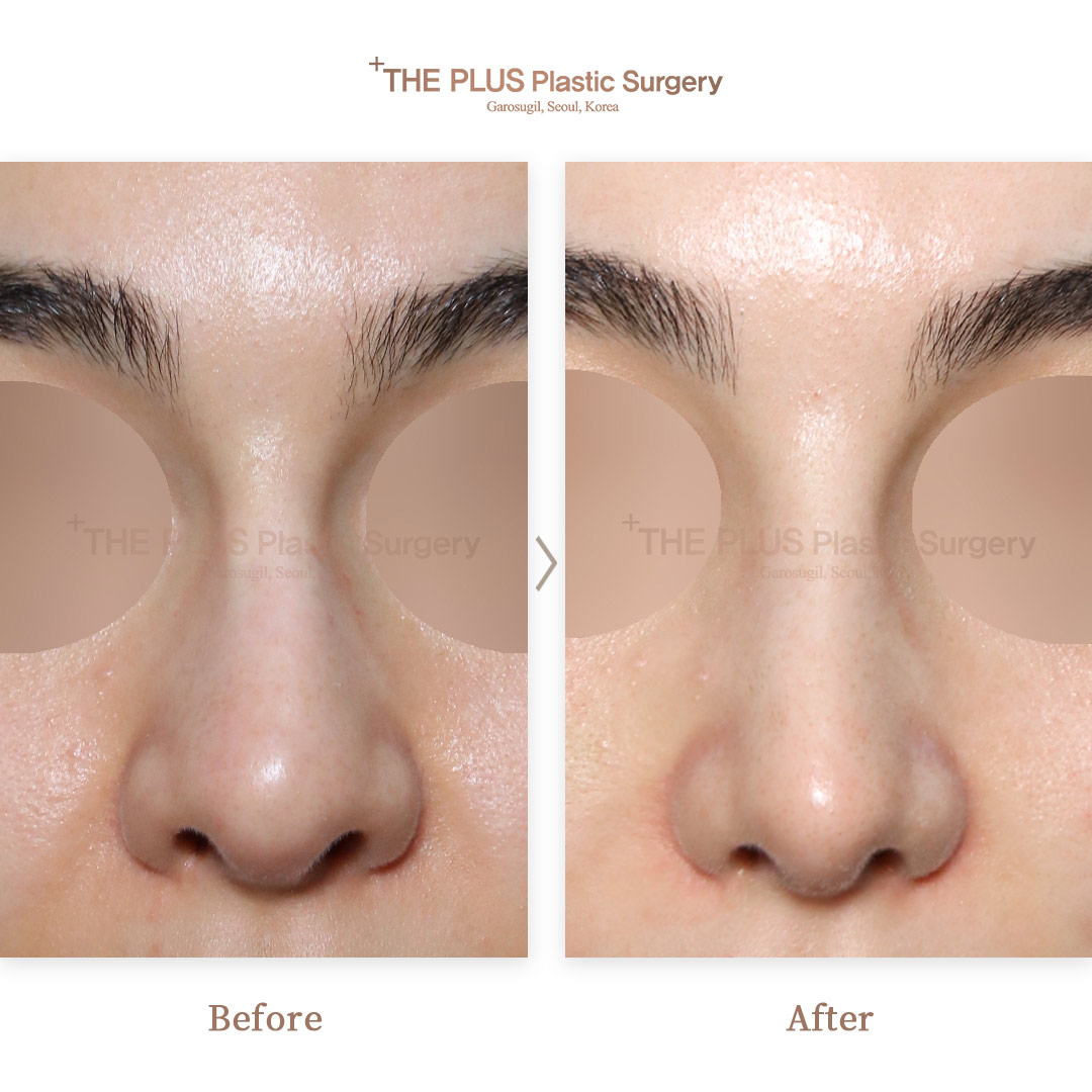 THE PLUS CLINIC KOREA -