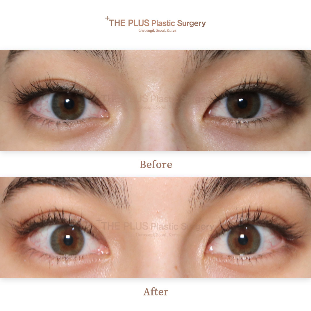THE PLUS CLINIC KOREA -