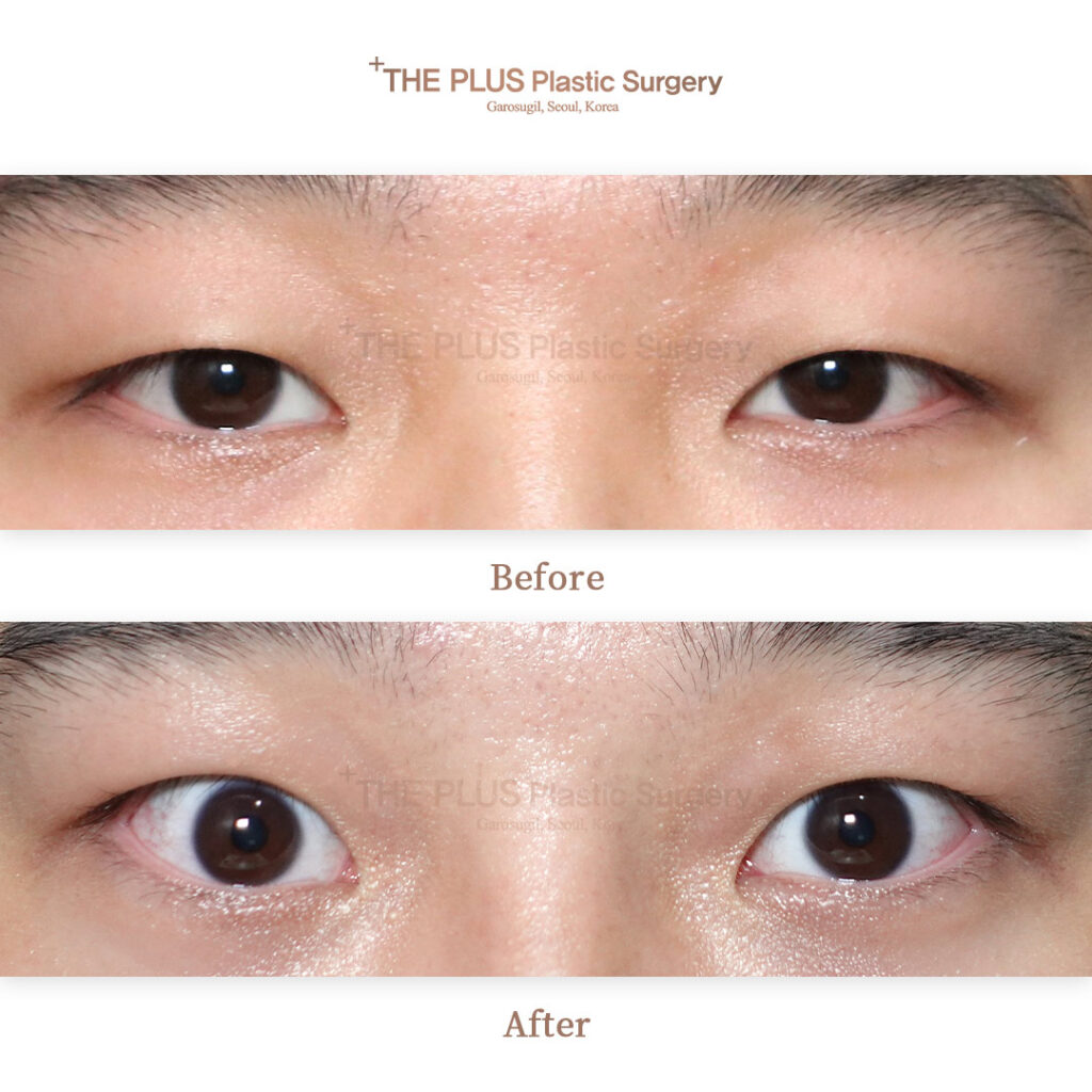 THE PLUS CLINIC KOREA -