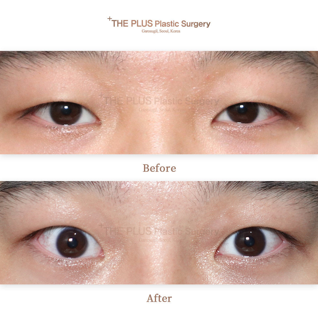 THE PLUS CLINIC KOREA -