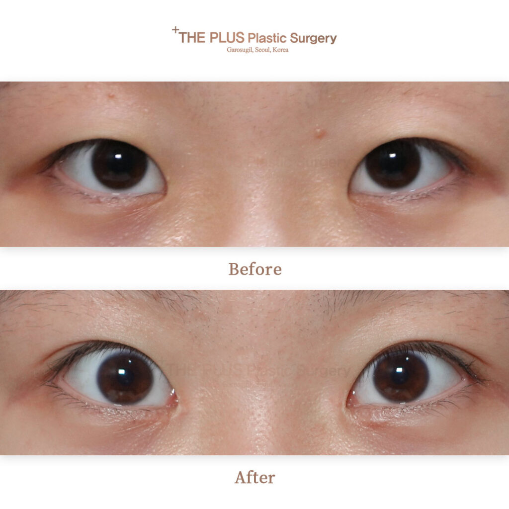 THE PLUS CLINIC KOREA -