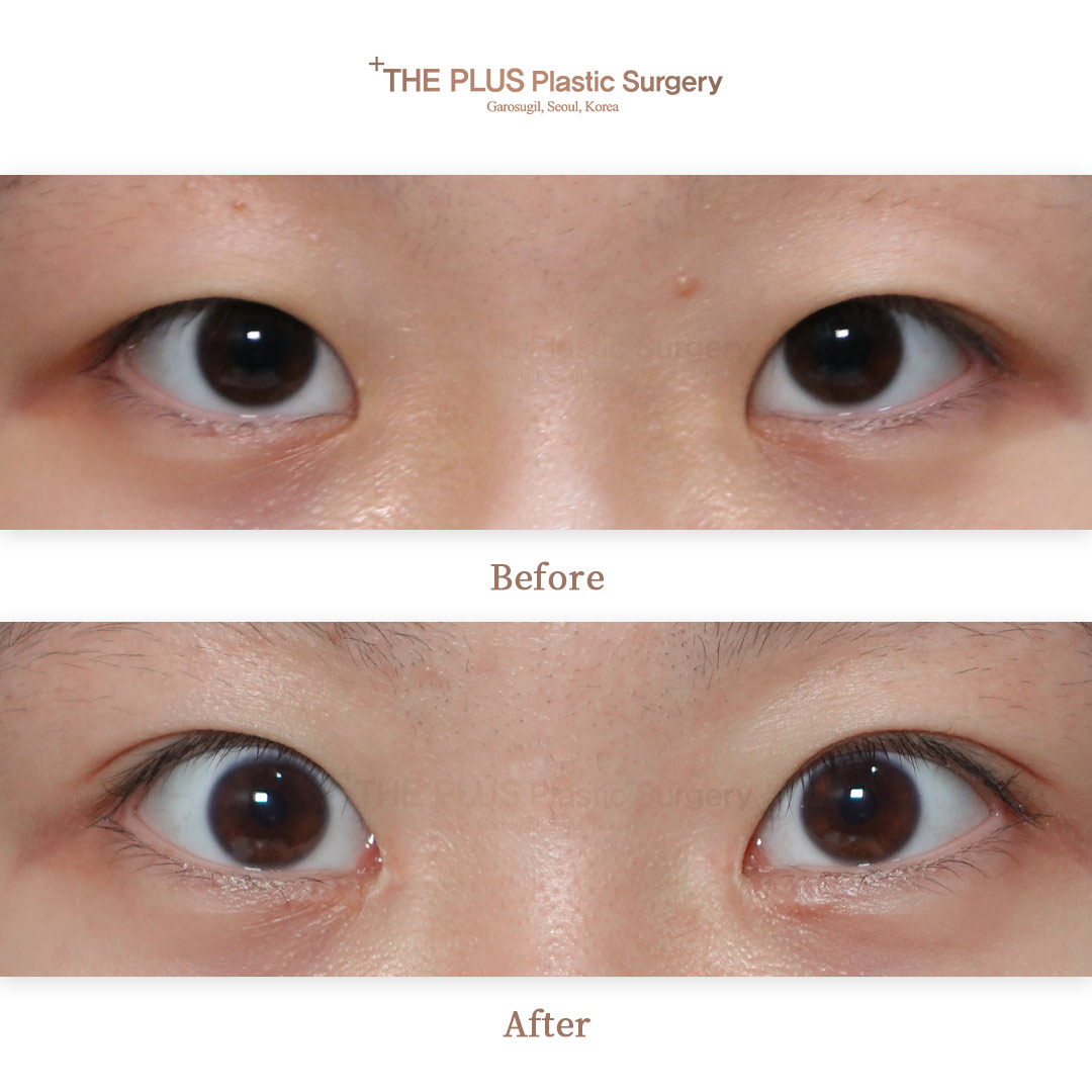 THE PLUS CLINIC KOREA -