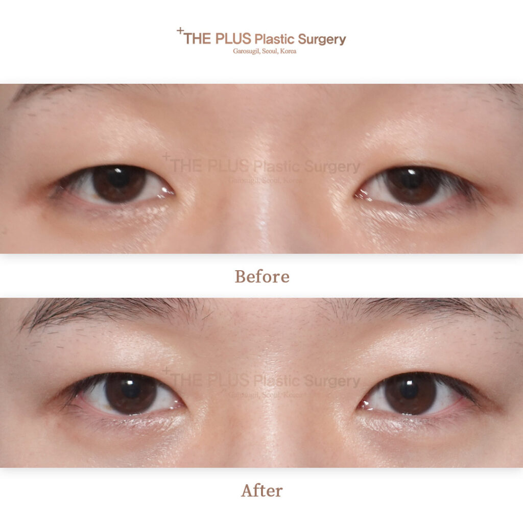 THE PLUS CLINIC KOREA -