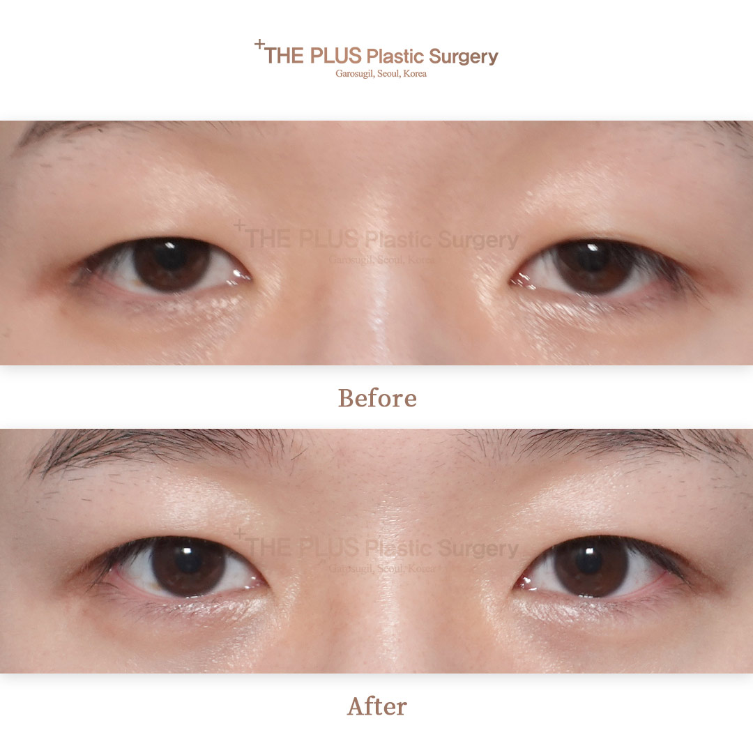 THE PLUS CLINIC KOREA -