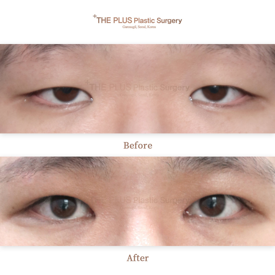 THE PLUS CLINIC KOREA -
