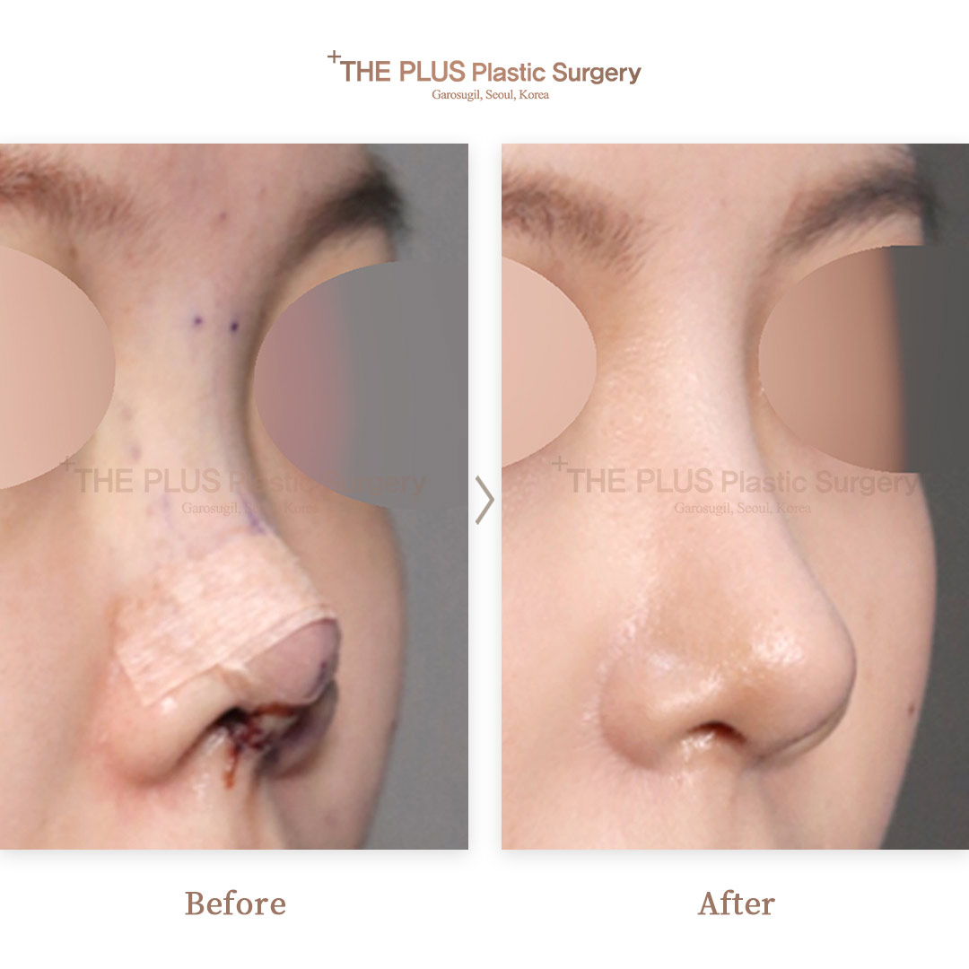 THE PLUS CLINIC KOREA -