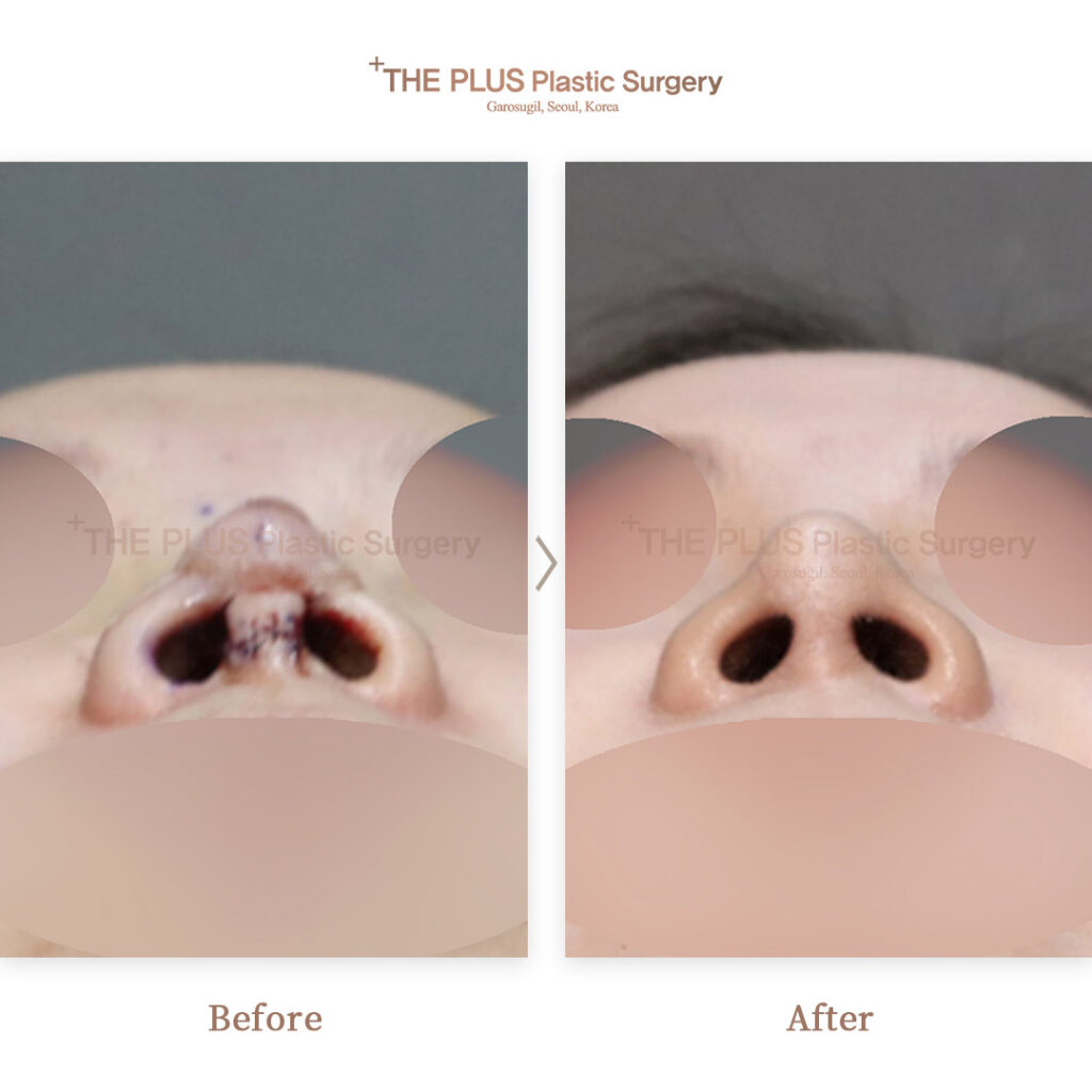 THE PLUS CLINIC KOREA -