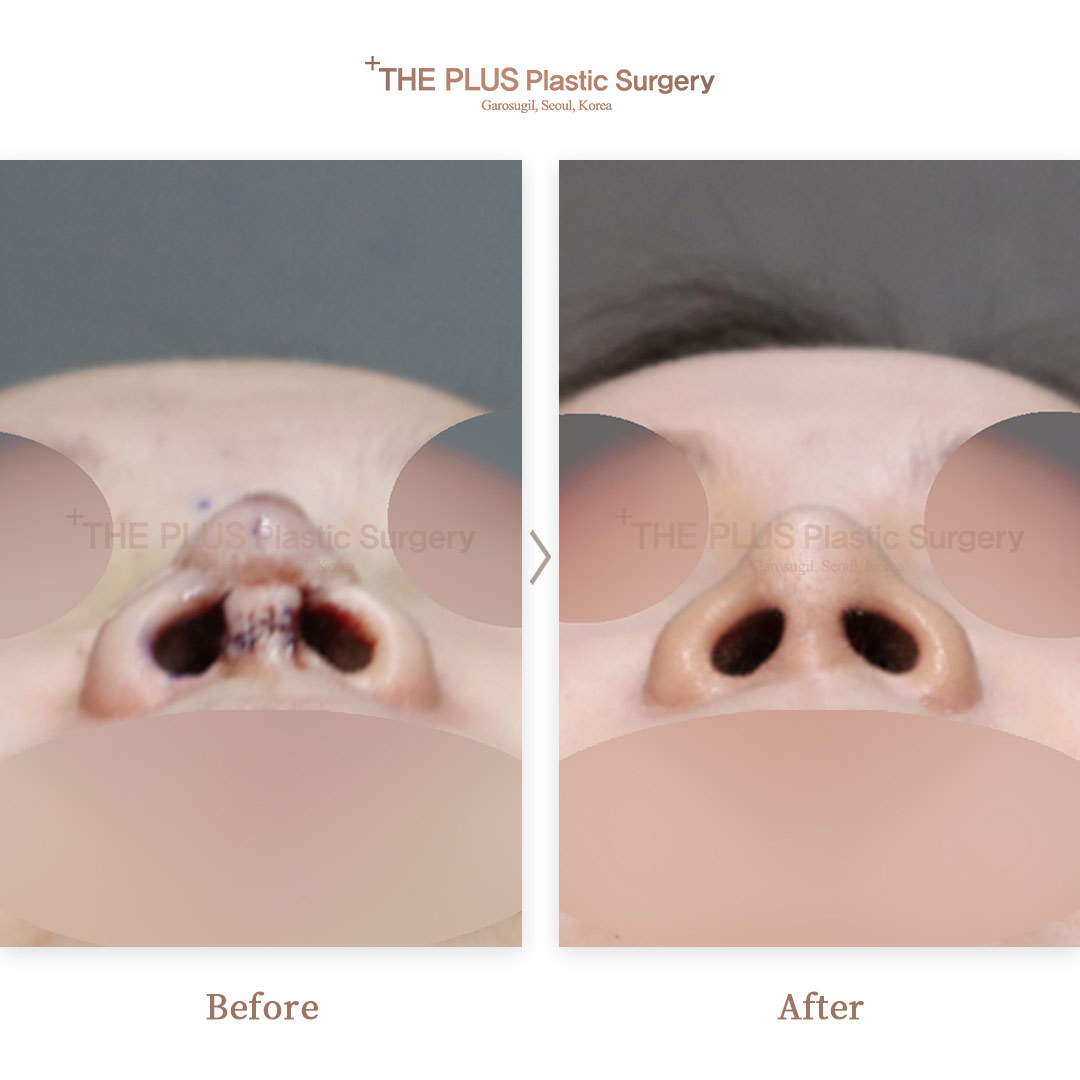 THE PLUS CLINIC KOREA -