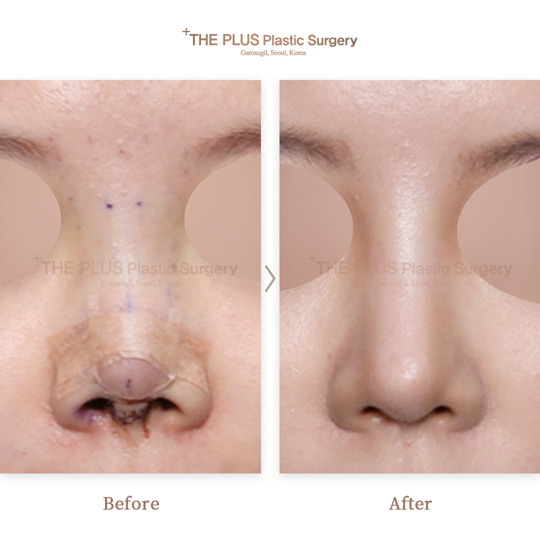 THE PLUS CLINIC KOREA -