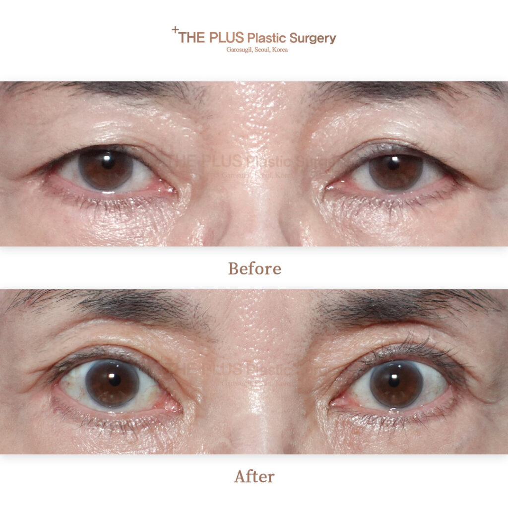 THE PLUS CLINIC KOREA -