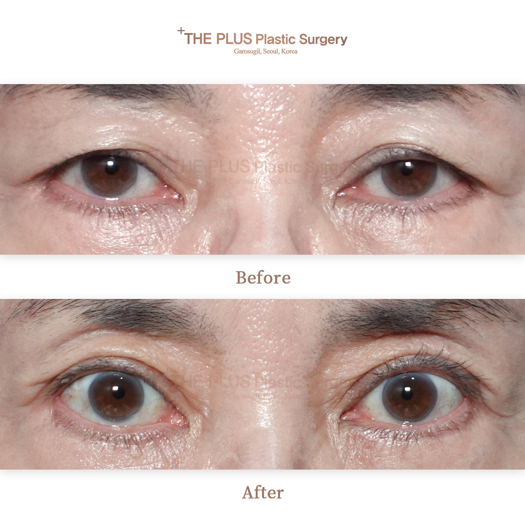 THE PLUS CLINIC KOREA -