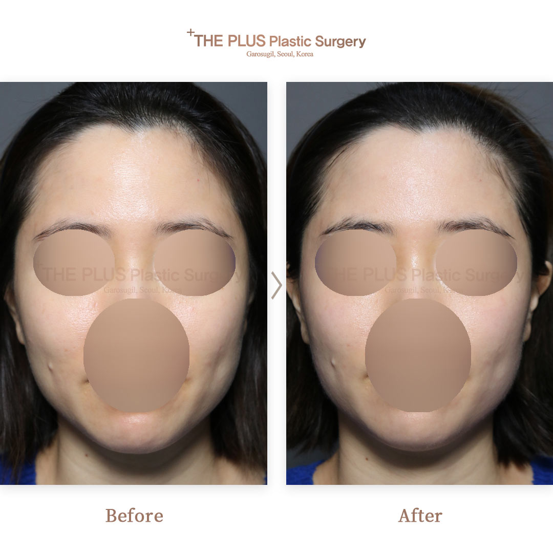 THE PLUS CLINIC KOREA -